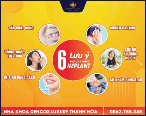 Sau Khi Trồng Răng Implant Nên Ăn Gì Để Vết Thương Nhanh Lành?