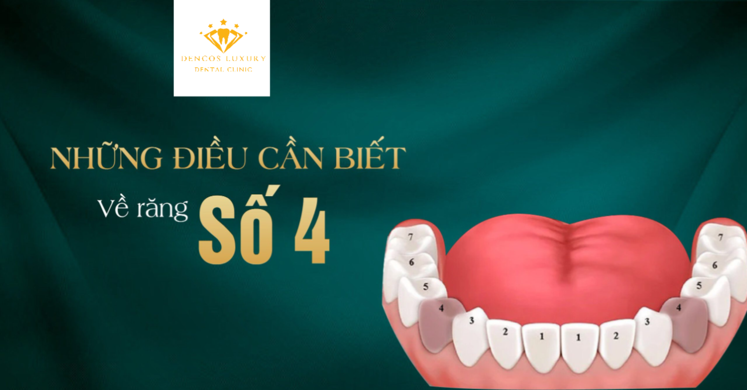 //avadental.vn/nhung-dieu-can-biet-ve-rang-so-4/