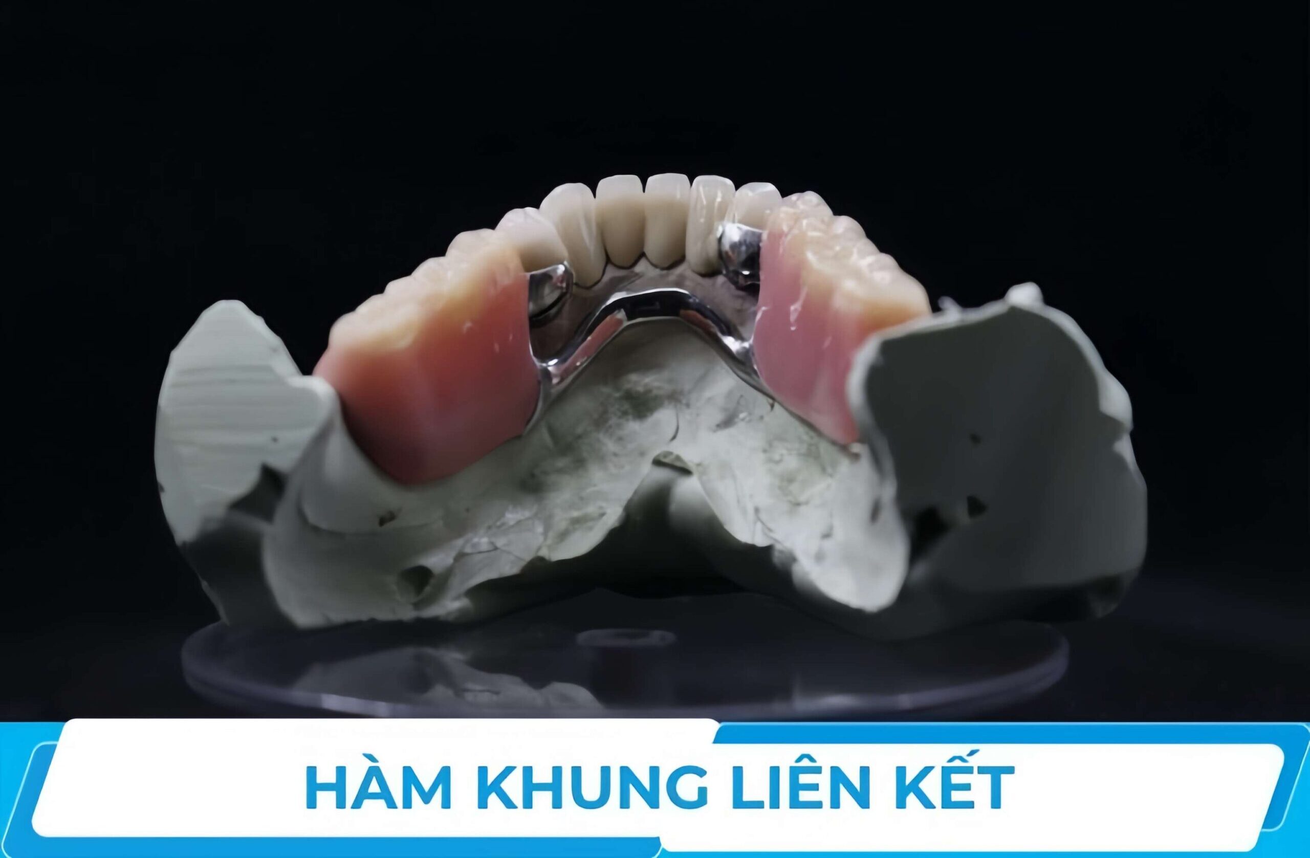 //nhakhoashark.vn/ham-khung-lien-ket/