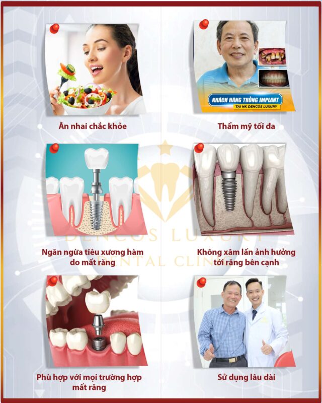 Top thực phẩm “vàng” giúp phục hồi nhanh sau cấy Implant
