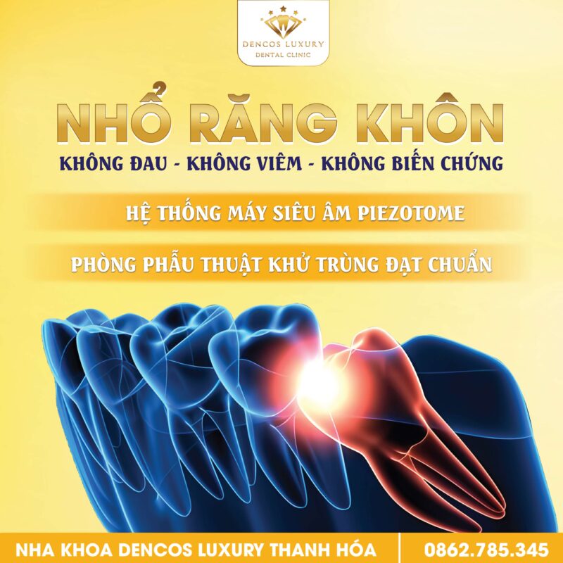 Tại Sao Nên Nhổ Răng Khôn