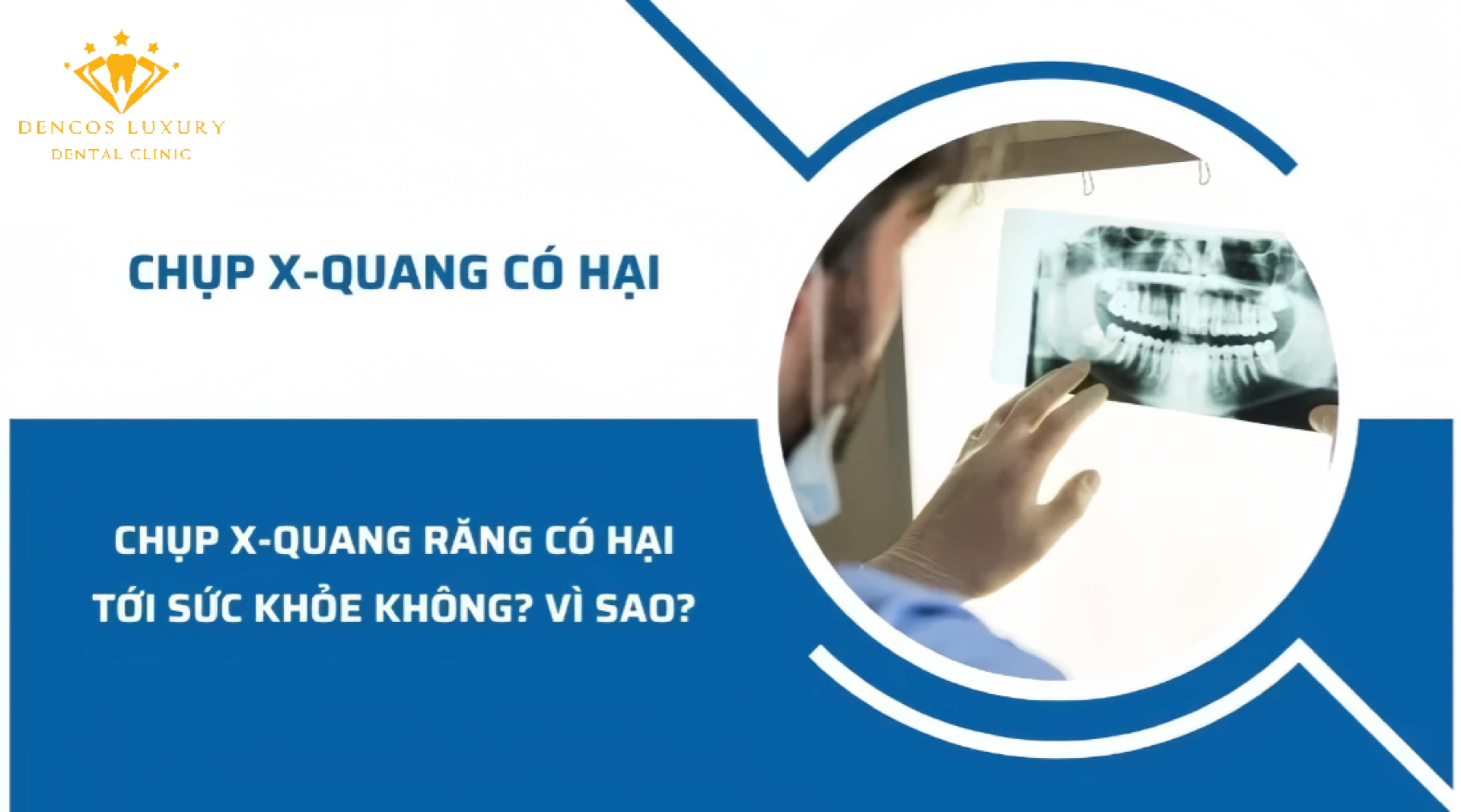 //www.google.com/url?sa=i&url=https%3A%2F%2Fnhakhoakim.com%2Fchup-x-quang-rang-co-hai-gi-khong.html&psig=AOvVaw33UCXdTse3ajzdVkfiQ0Vg&ust=1747531966997000&source=images&cd=vfe&opi=89978449&ved=0CBcQjhxqFwoTCKjTjoSuqY0DFQAAAAAdAAAAABAE