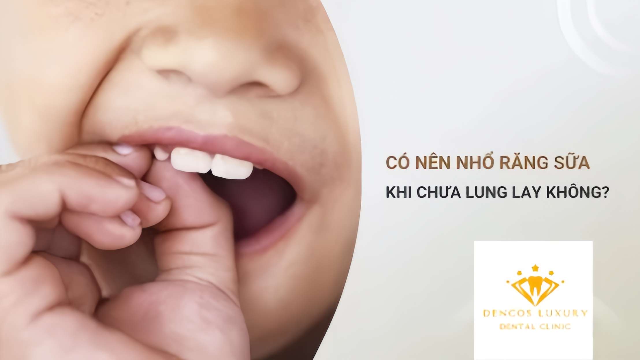 //nhakhoathanhtam.com/co-nen-nho-rang-sua-khi-chua-lung-lay-khong/