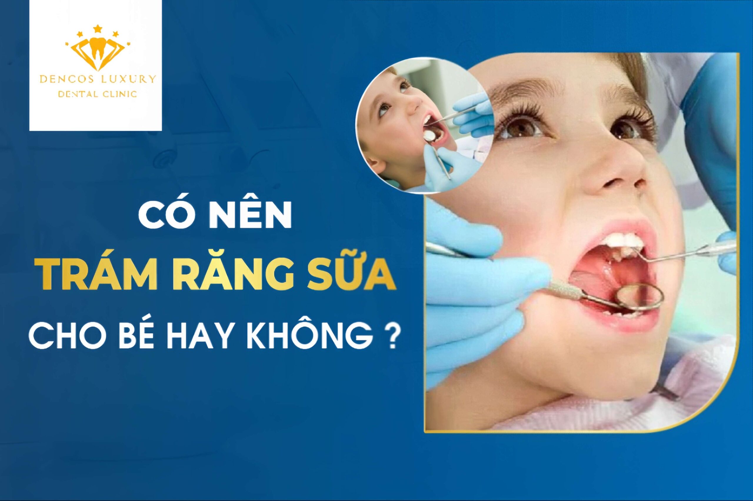 https://nhakhoathuyduc.com.vn/rang-sua-bi-sau-co-nen-han-12405/