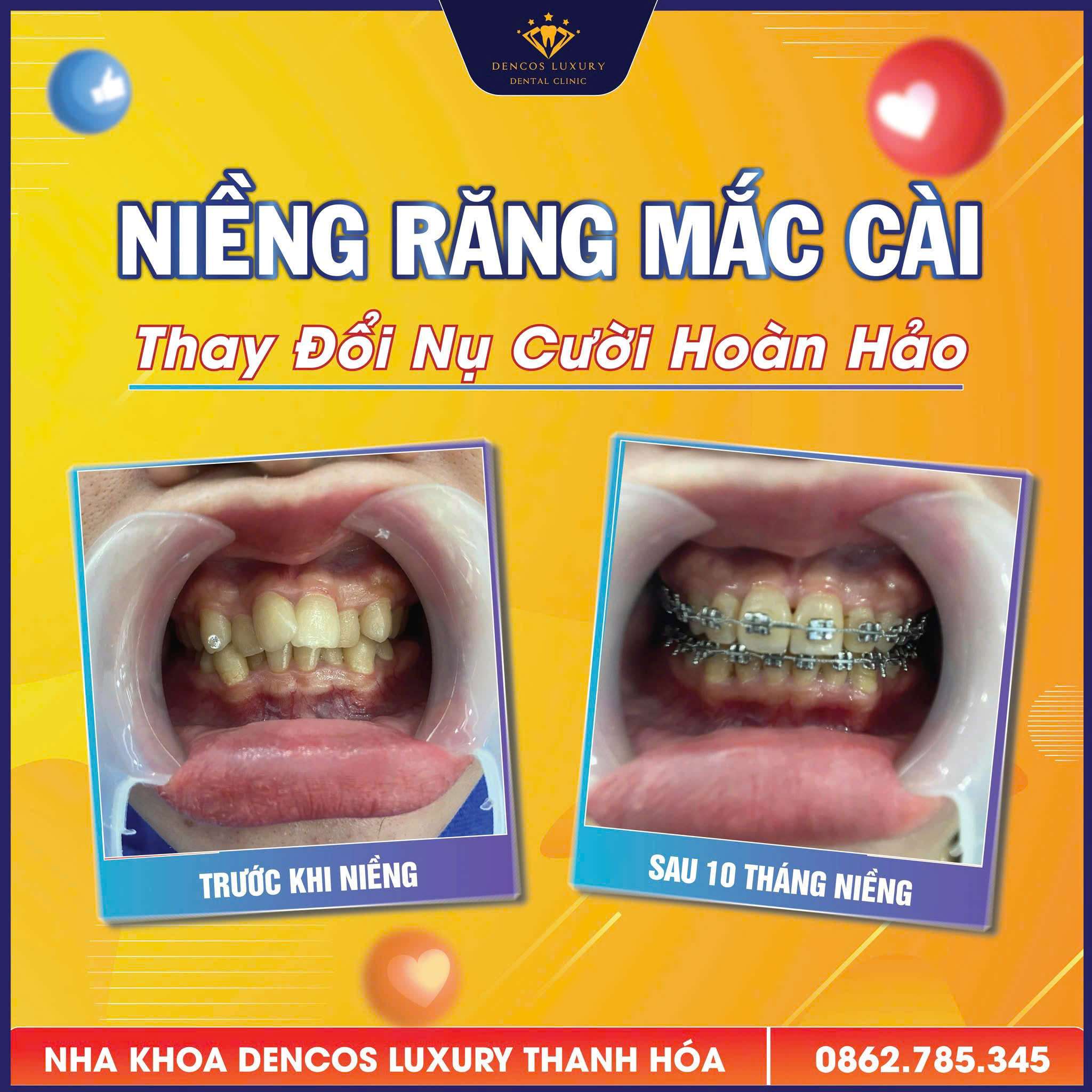 https://sotongdai.com/vien-nha-khoa-tham-my-dencos-luxury-thanh-hoa/